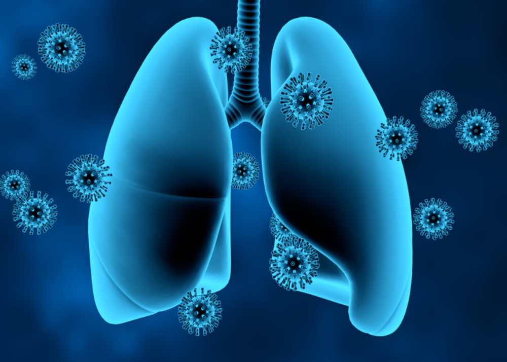COPD patients