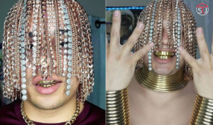 Viral Pics: Mexican Rapper Dan Sur Gets Gold Chains Implanted In His Head