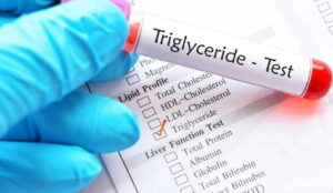 Triglyceride